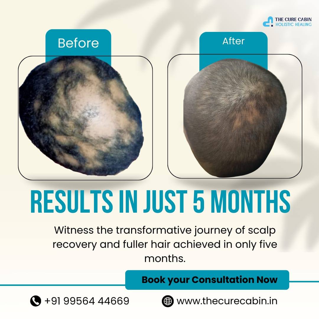 Before and after patient result