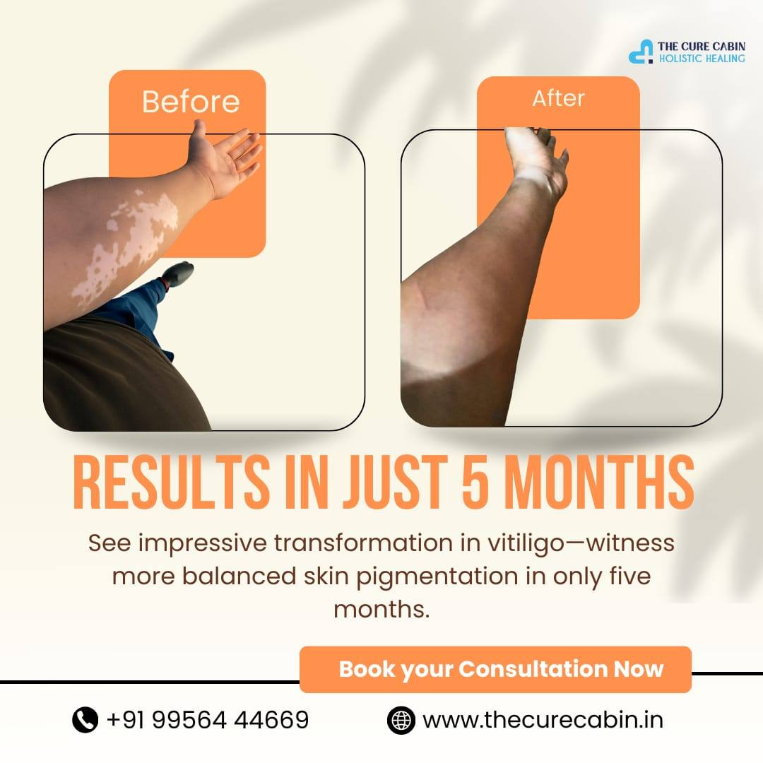 Before and after patient result