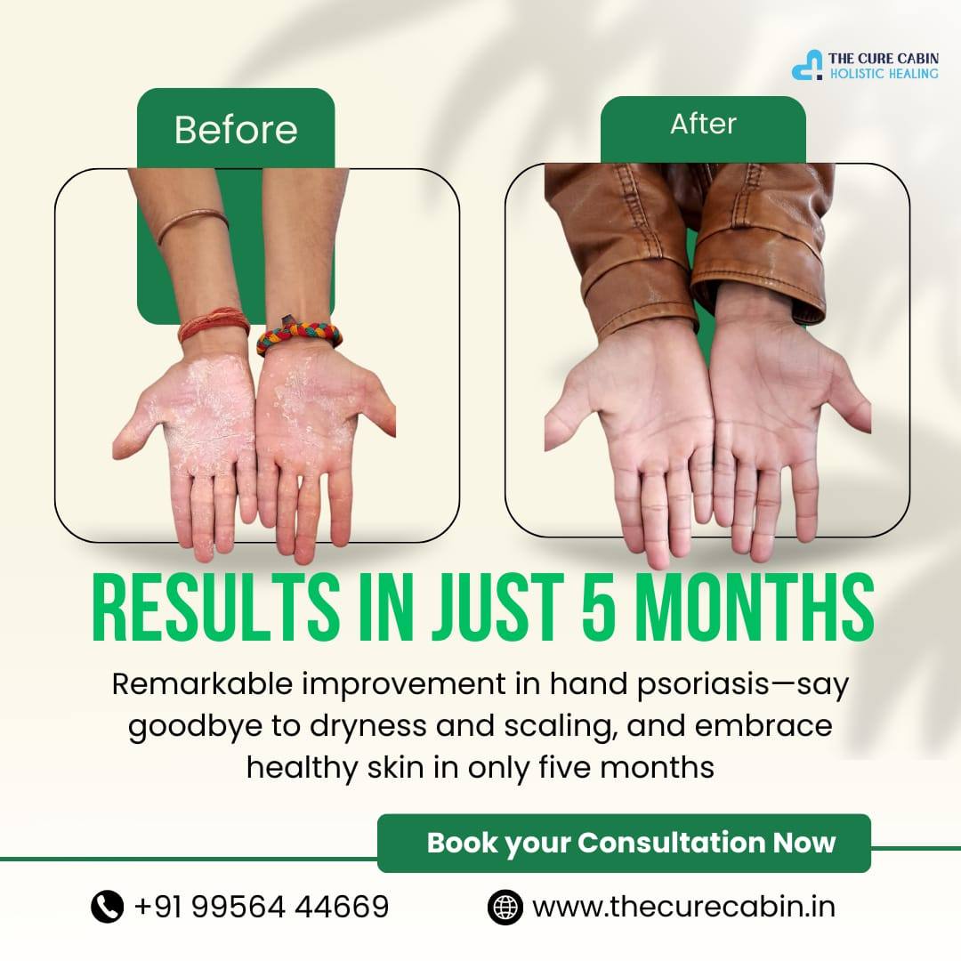 Before and after patient result